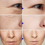 Vitamin C Serum Facial Serum Amazon - Ever Bloom Now
