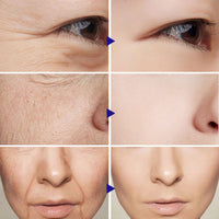 Vitamin C Serum Facial Serum Amazon - Ever Bloom Now