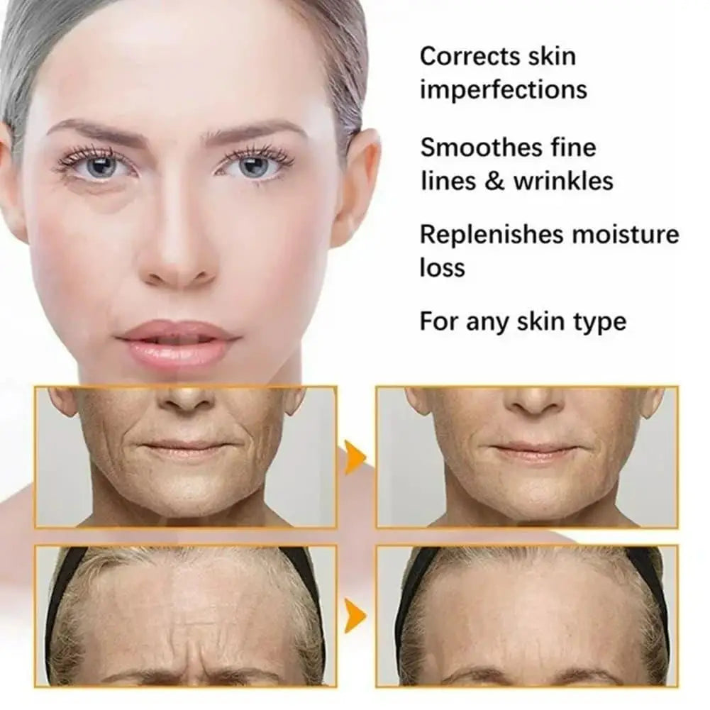 Multi-Peptide Collagen Microneedling Skin Care Set Firming Rejuvenating Skin Deep Moisturizing Brand Carvenchy Microinfusion Kit