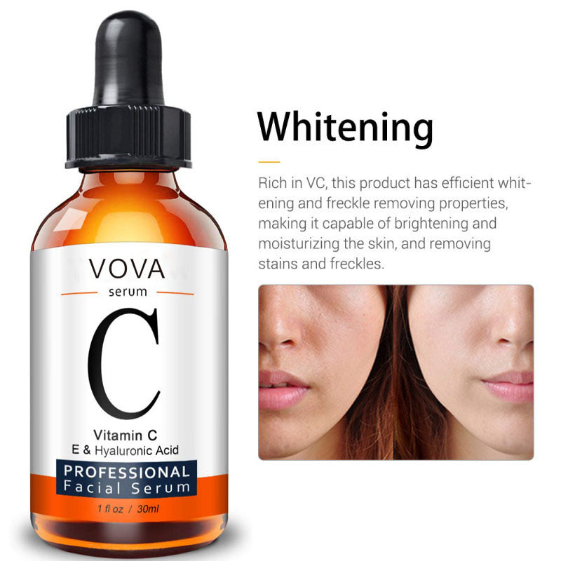 Vitamin C Serum Facial Serum Amazon - Ever Bloom Now